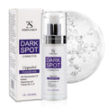 [Upgraded] Dark Spot Remover for Face Dark Spot Correcting Glow Serum with Niacinamide Retinol and Vitamin C Rapid Skin Brown Spot Remover Sun Spot Age Spot Corrector for Daily Skincare 1FLOZ/30ML My Store